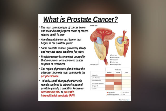 Prostate cancer, every man’s curse | The ManicaPost